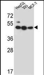 LIPJ Antibody in Western Blot (WB)