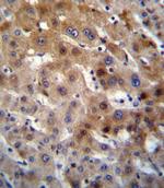 UGT2B15 Antibody in Immunohistochemistry (Paraffin) (IHC (P))