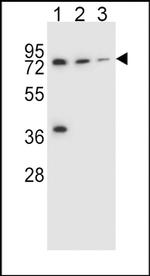 UGT2B15 Antibody in Western Blot (WB)