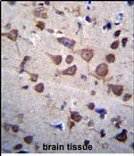 PIGA Antibody in Immunohistochemistry (Paraffin) (IHC (P))