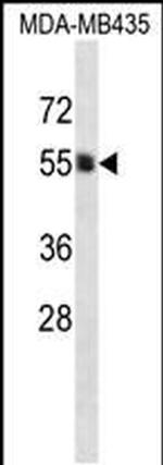 PIGA Antibody in Western Blot (WB)