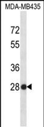 SNRPB2 Antibody in Western Blot (WB)