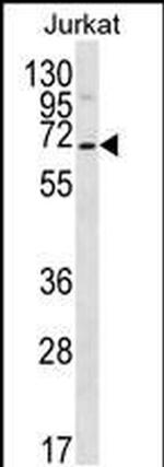 PSAPL1 Antibody in Western Blot (WB)