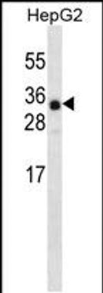 ANKRD46 Antibody in Western Blot (WB)