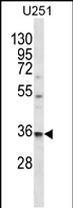 VPS37B Antibody in Western Blot (WB)