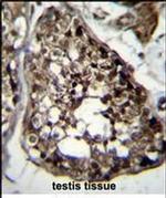 TBCEL Antibody in Immunohistochemistry (Paraffin) (IHC (P))