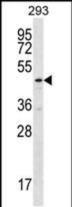 TBCEL Antibody in Western Blot (WB)