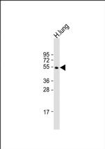 RASSF10 Antibody in Western Blot (WB)