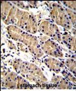 WFDC1 Antibody in Immunohistochemistry (Paraffin) (IHC (P))