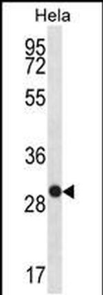 WFDC1 Antibody in Western Blot (WB)