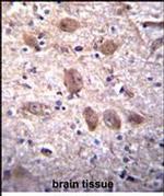 SPG7 Antibody in Immunohistochemistry (Paraffin) (IHC (P))