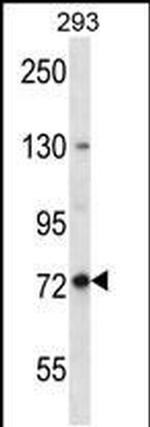 SPG7 Antibody in Western Blot (WB)