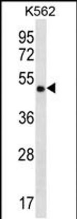 CCDC71 Antibody in Western Blot (WB)