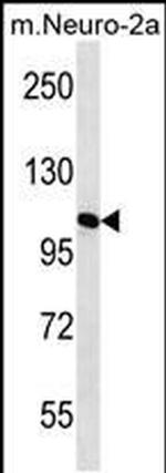 MAN2A2 Antibody in Western Blot (WB)