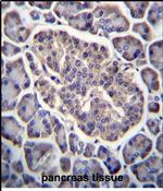 GPD2 Antibody in Immunohistochemistry (Paraffin) (IHC (P))