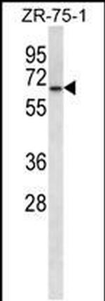GPD2 Antibody in Western Blot (WB)