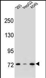 ZNF569 Antibody in Western Blot (WB)