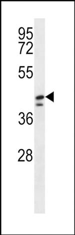 DUS1L Antibody in Western Blot (WB)