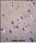 MCF2 Antibody in Immunohistochemistry (Paraffin) (IHC (P))