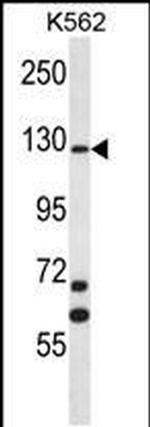 MCF2 Antibody in Western Blot (WB)