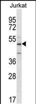 ABI2 Antibody in Western Blot (WB)