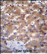UBE2NL Antibody in Immunohistochemistry (Paraffin) (IHC (P))