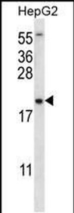 UBE2NL Antibody in Western Blot (WB)