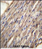 ACSM6 Antibody in Immunohistochemistry (Paraffin) (IHC (P))