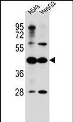 ACSM6 Antibody in Western Blot (WB)
