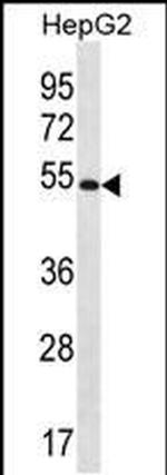 MGAT4C Antibody in Western Blot (WB)
