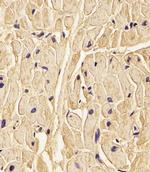 PLOD1 Antibody in Immunohistochemistry (PFA fixed) (IHC (PFA))