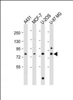PLOD1 Antibody in Western Blot (WB)
