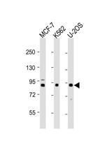 PLOD1 Antibody in Western Blot (WB)