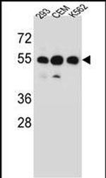 ZNF562 Antibody in Western Blot (WB)