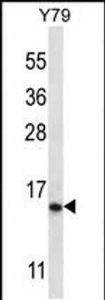 NR2C2AP Antibody in Western Blot (WB)