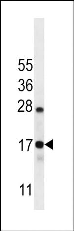 C15orf40 Antibody in Western Blot (WB)