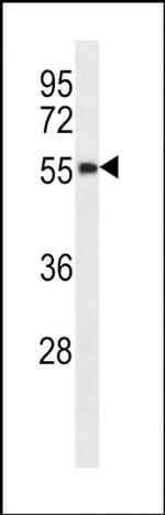 RBM48 Antibody in Western Blot (WB)