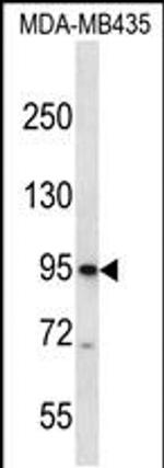 CNGB3 Antibody in Western Blot (WB)