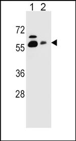 SLC23A1 Antibody in Western Blot (WB)