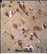 RIC3 Antibody in Immunohistochemistry (Paraffin) (IHC (P))