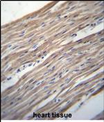 HRC Antibody in Immunohistochemistry (Paraffin) (IHC (P))