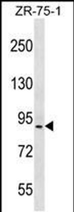 HRC Antibody in Western Blot (WB)