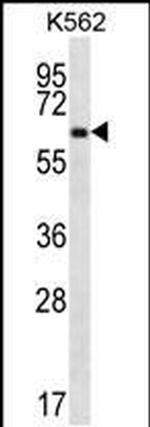 ZNF623 Antibody in Western Blot (WB)
