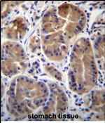 SYPL1 Antibody in Immunohistochemistry (Paraffin) (IHC (P))