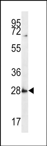 SYPL1 Antibody in Western Blot (WB)
