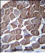 NPHP3 Antibody in Immunohistochemistry (Paraffin) (IHC (P))