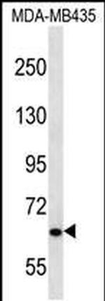 NPHP3 Antibody in Western Blot (WB)
