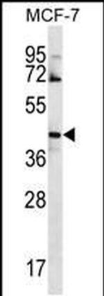 GNA14 Antibody in Western Blot (WB)