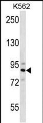 STRN4 Antibody in Western Blot (WB)