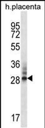 DNAJC27 Antibody in Western Blot (WB)